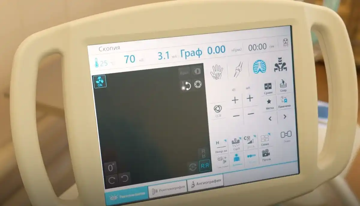 Новый аппарат позволяет проводить ангиографические исследования.