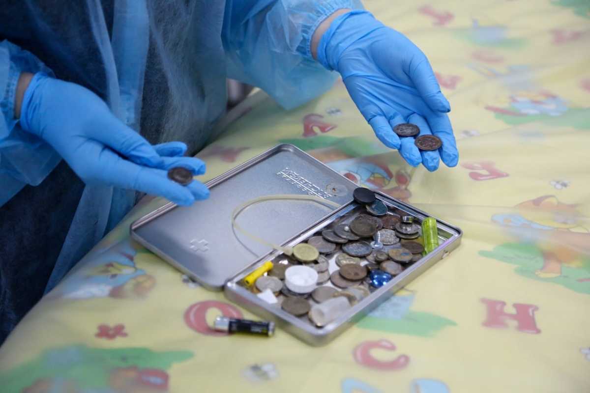 Дети глотают монеты, батарейки, колпачки от ручек, детали игрушек, магнитные шарики и даже иголки.