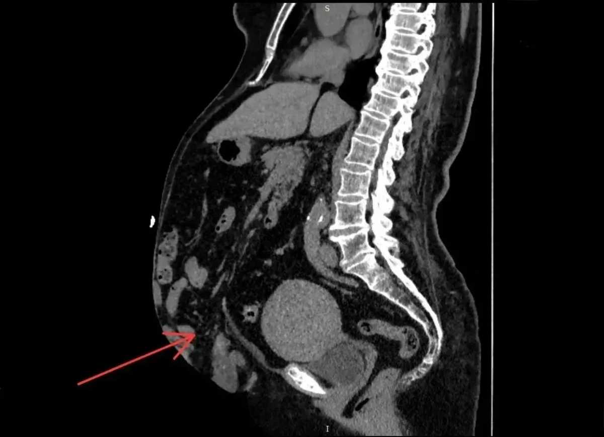 Такое состояние называется потерей домена.