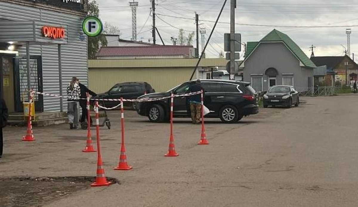 Подростку диагностировали перелом голени. Подростку диагностировали перелом голени.