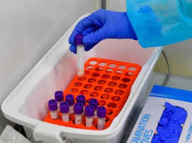В Волотовском районе зарегистрировано 12 случаев заражения новой коронавирусной инфекцией.