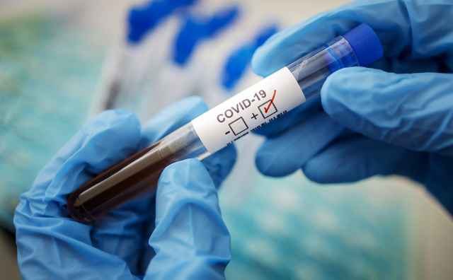 Всего в стране зарегистрировано 627646 случаев коронавирусной инфекции в 85 регионах.