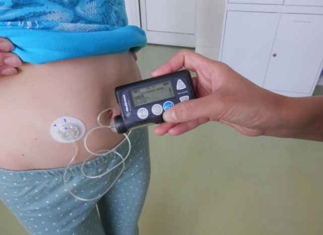 Ориентировочная дата поступления в Новгородскую область расходных материалов для инсулинов помп для детей с с сахарным диабетом – 10 октября.