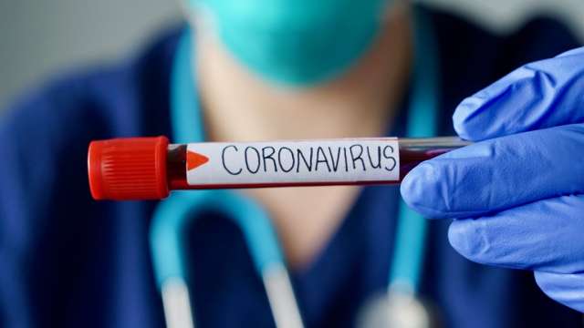 Всего в регионе зафиксировали 19 335 случаев новой коронавирусной инфекции.