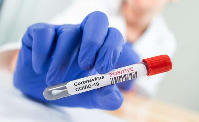 Всего в регионе коронавирусом заболели 21 280 жителей.