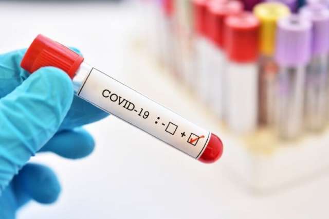 За невыполнение требований об обязательном тестировании на коронавирус нарушителям грозят штрафы от 15 тысяч до 40 тысяч рублей.