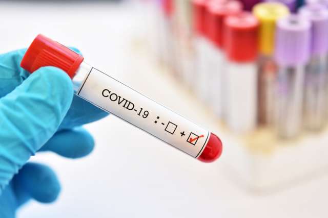 За минувшие сутки в регионе от коронавируса выздоровел 151 житель. Всего COVID-19 в Новгородской области переболели 39 519 человек.
