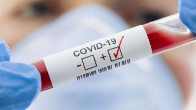 За минувшие сутки в регионе выявили 280 случаев заражения коронавирусом