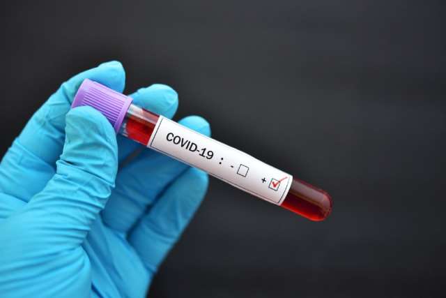 За минувшие сутки в регионе от коронавируса выздоровел 101 житель. Всего COVID-19 в Новгородской области переболели 46 075 человек.