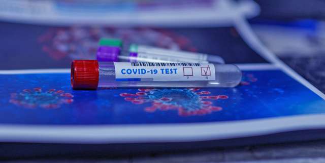 Результаты экспресс-тестов на коронавирус жителям отдалённых сел будут доступны на портале Госуслуг