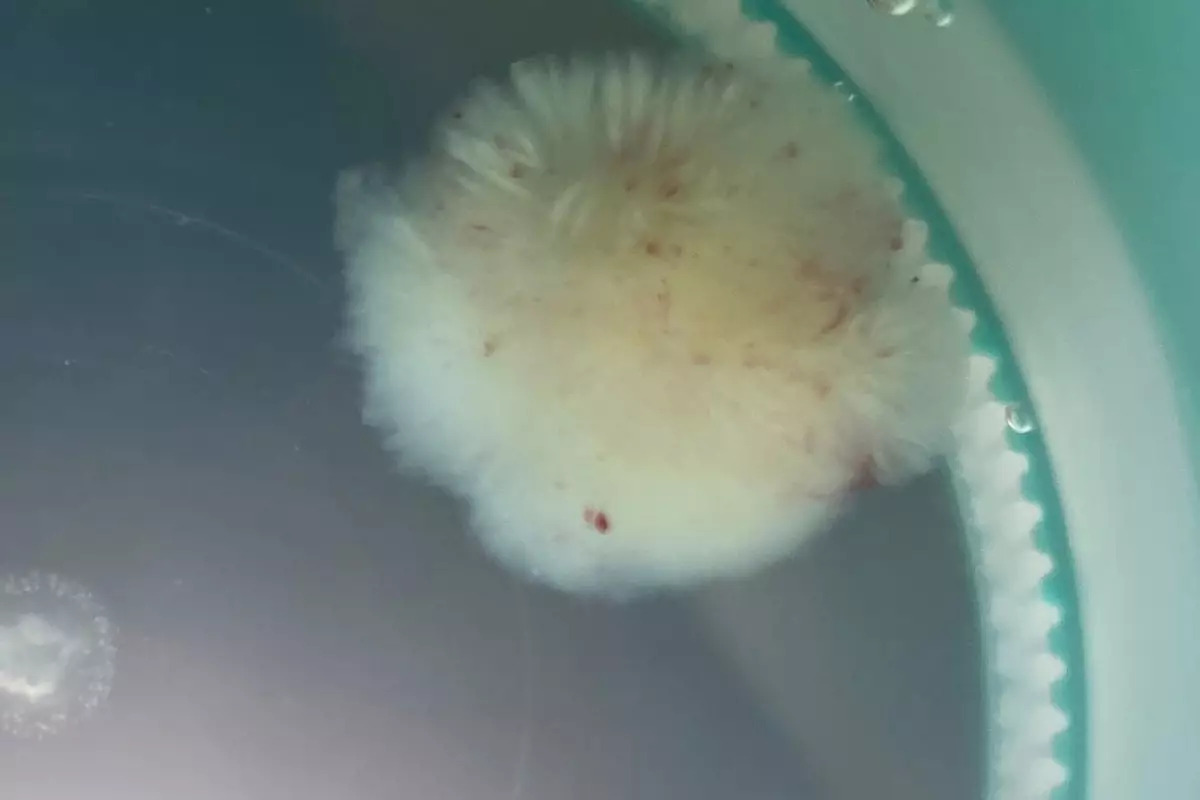 Внешне папиллярная фиброэластома похожа на анемоны — коралловые полипы – небольшое мягкое пушистое образование, крепящееся на тонкой ножке.