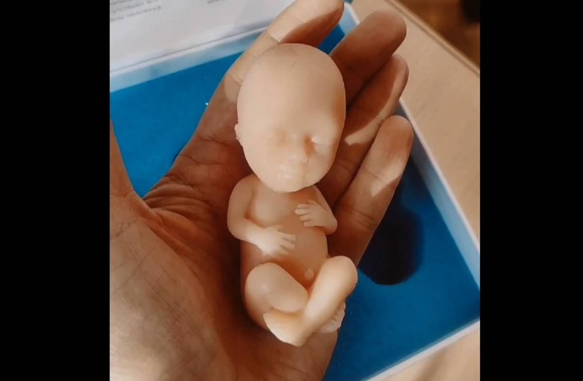 Размеры фигурок соответствуют реальным параметрам ребёнка в разные периоды внутриутробного развития.